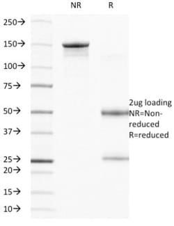 Integrin beta 4/CD104 Antibody (UM-A9), Novus Biologicals:Antibodies:Primary